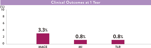  Xience Stent