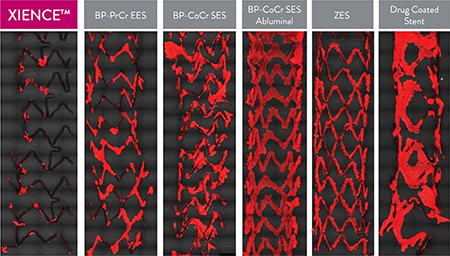 XIENCE Stent