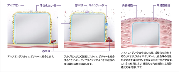 xience stent