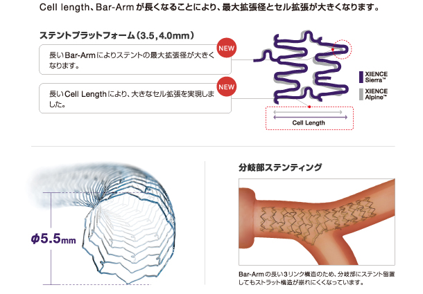 xience stent