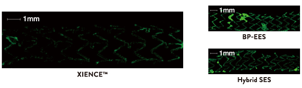 XIENCE Skypoint Stent 