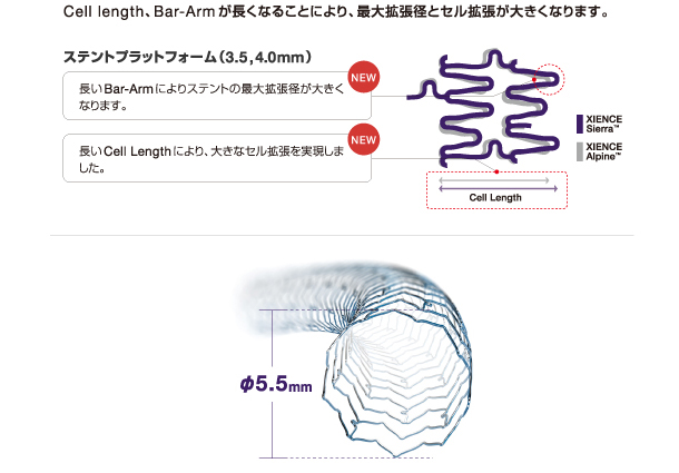 xience stent