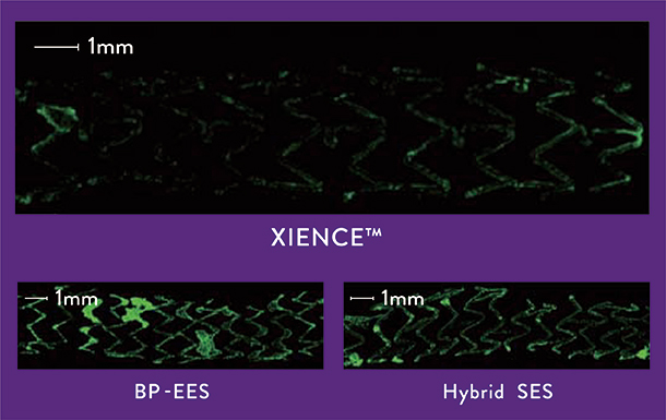 XIENCE Skypoint Stent 