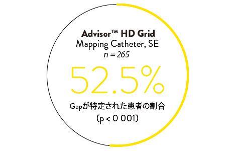 HD Grid Mapping Cathethers 52.5%