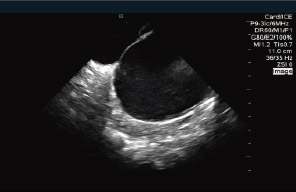 viewMate ultrasound system img01