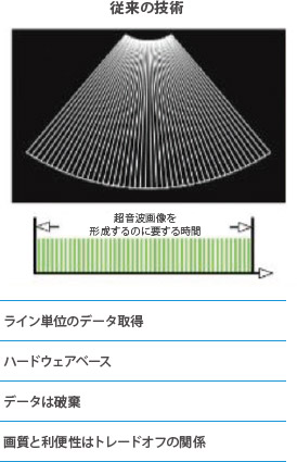 Advisor HD Grid Waveform