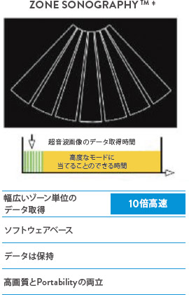 Advisor HD Grid Waveform