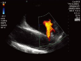 viewMate ultrasound system img06