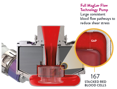 Cut across view of the HeartMate 3 Maglev Pump