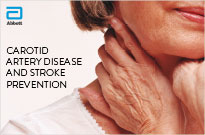 Carotid Artery Disease and Stroke Prevention Patient Brochure