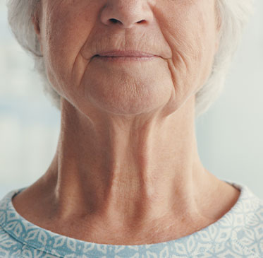 what is carotid artery disease?