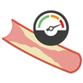 Peripheral Artery Disease (PAD) High Cholesterol Pressure Risk Factor