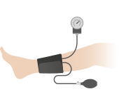 Ankle Brachial Index for Peripheral Artery Disease Diagnosis