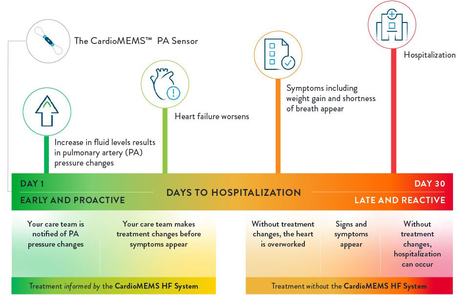 Early treatment for heart failure is essential. This chart shows the progression of heart failure and where pa pressure changes can be observed.