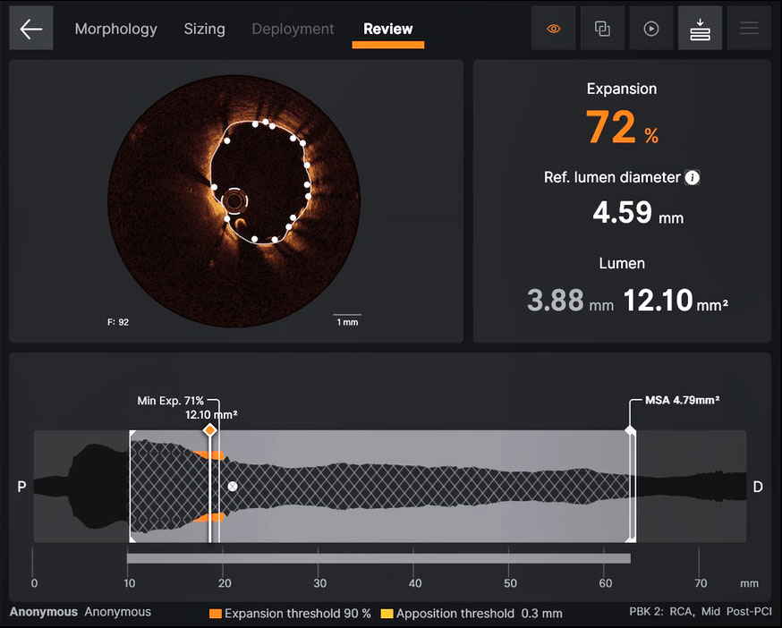 Ultreon™ 1.0 Software-Interface zur Überprüfung des Ergebnisses