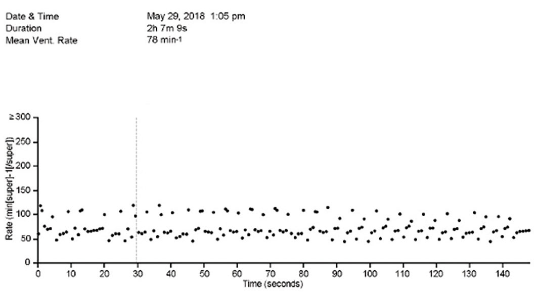Scatterplot View