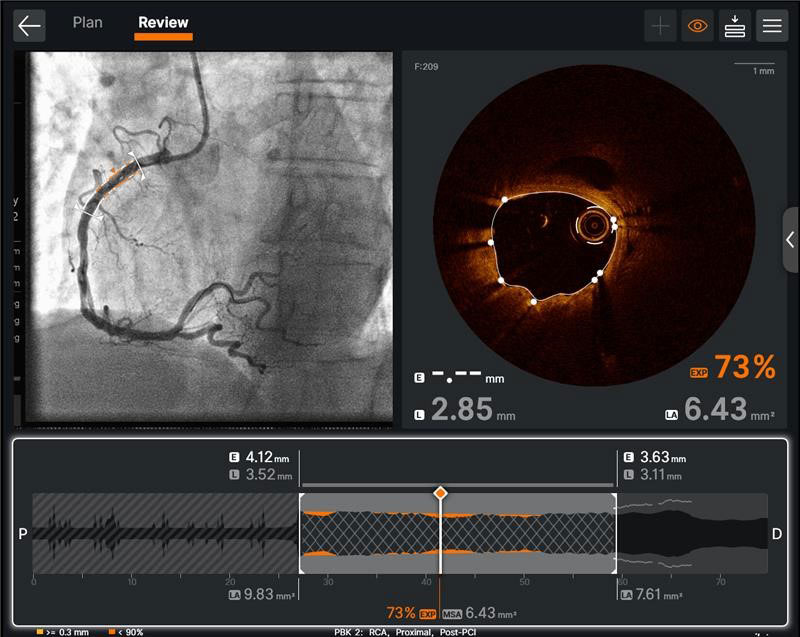  Ultreon™ 1.0 Software User Interface