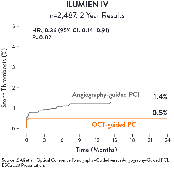 OCT Angiography ILUMIEN Trial Chart