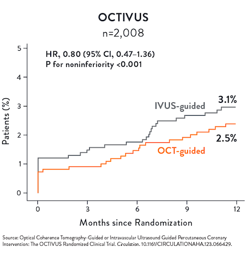 OCT vs IVUS Clinical trial chart