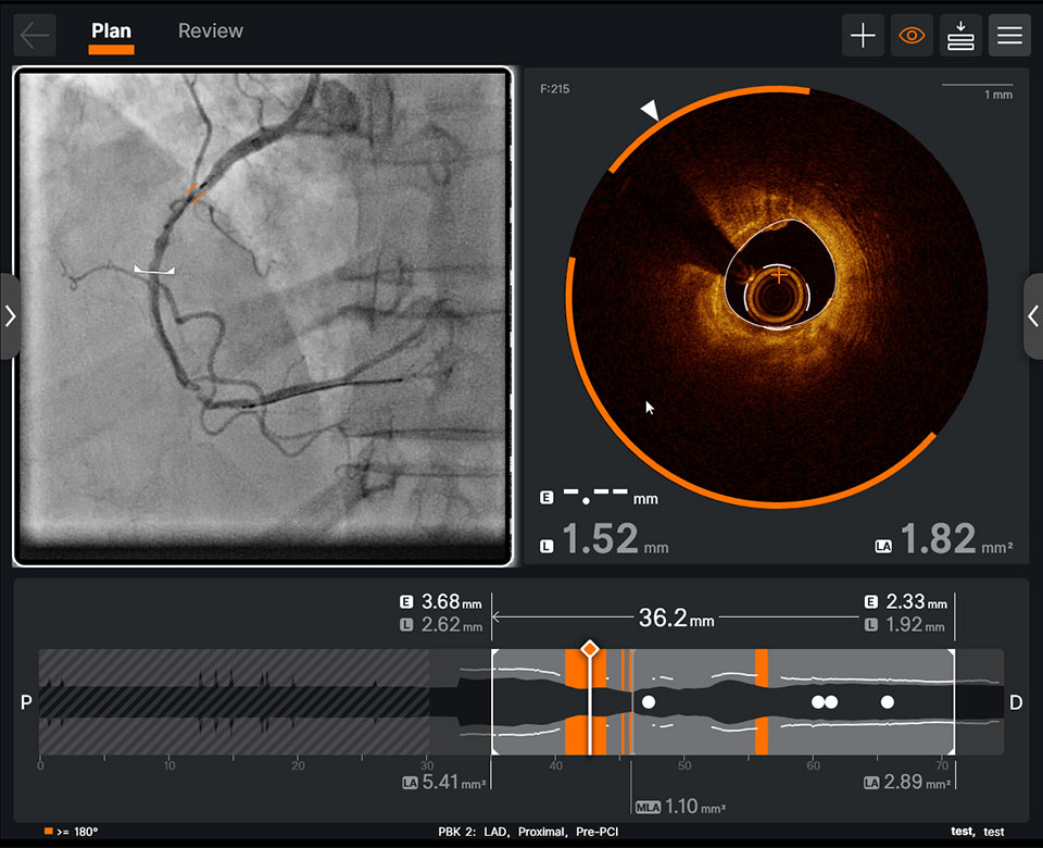  OCT software features