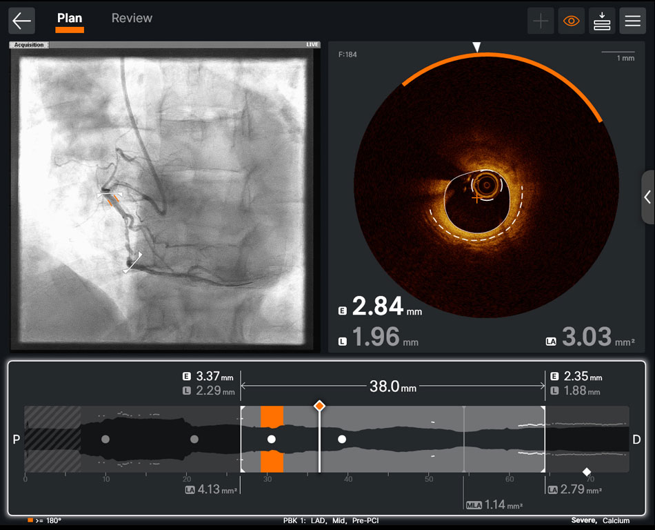 Ultreon 2.0 Software