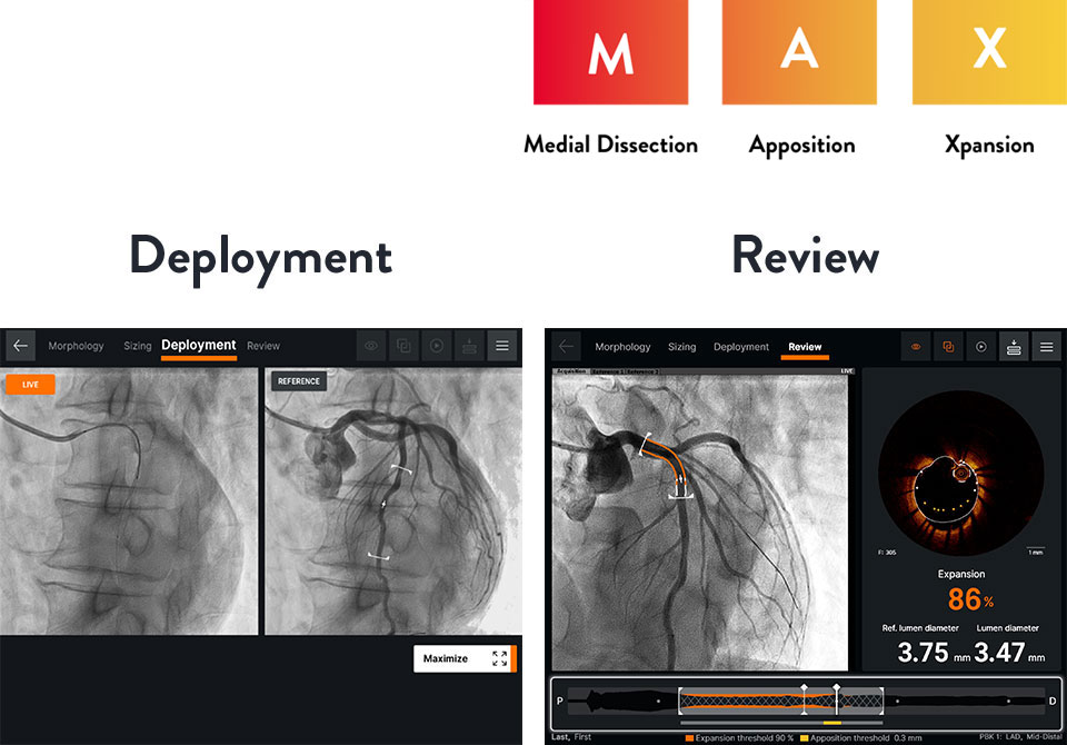 Ultreon™ 1.0 Software intuitive workflow interface - MAX