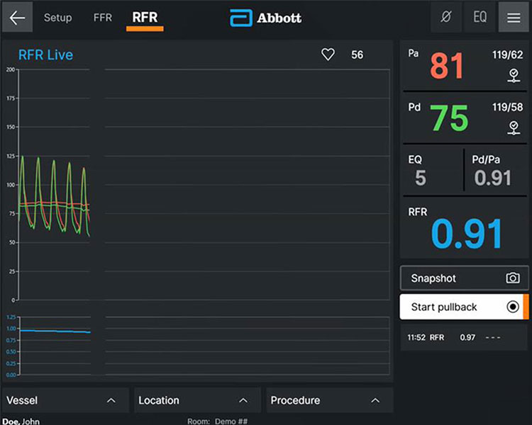 Ultreon Software 2.0 for both OCT and Physiology