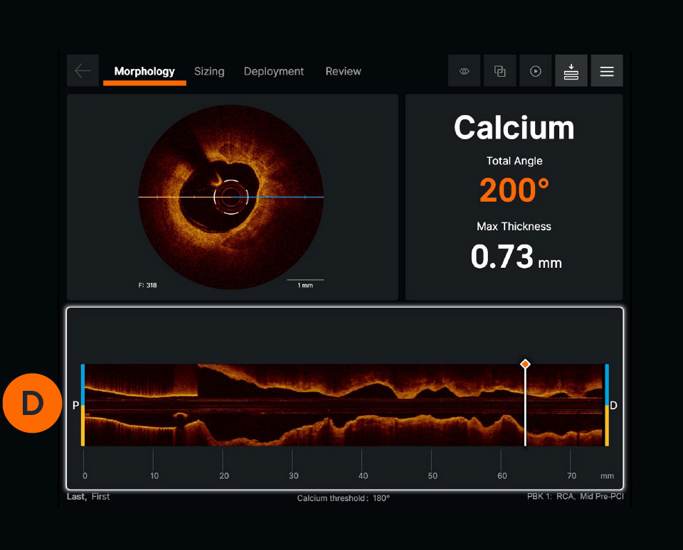  Ultreon™ 1.0 Software User Interface