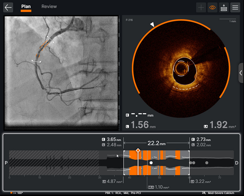  OCT software features