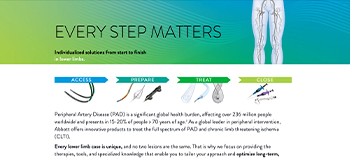 Every Step Matters