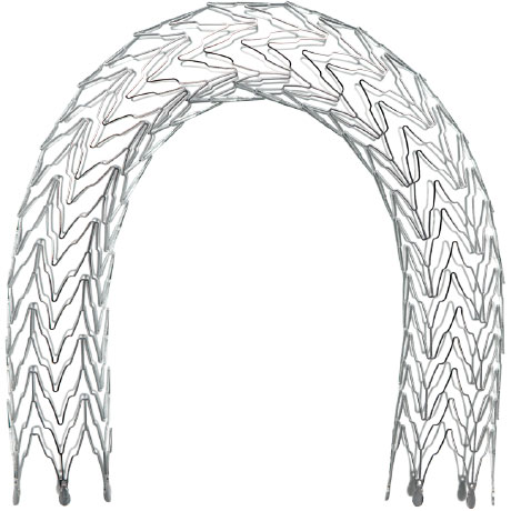 Stent Loop